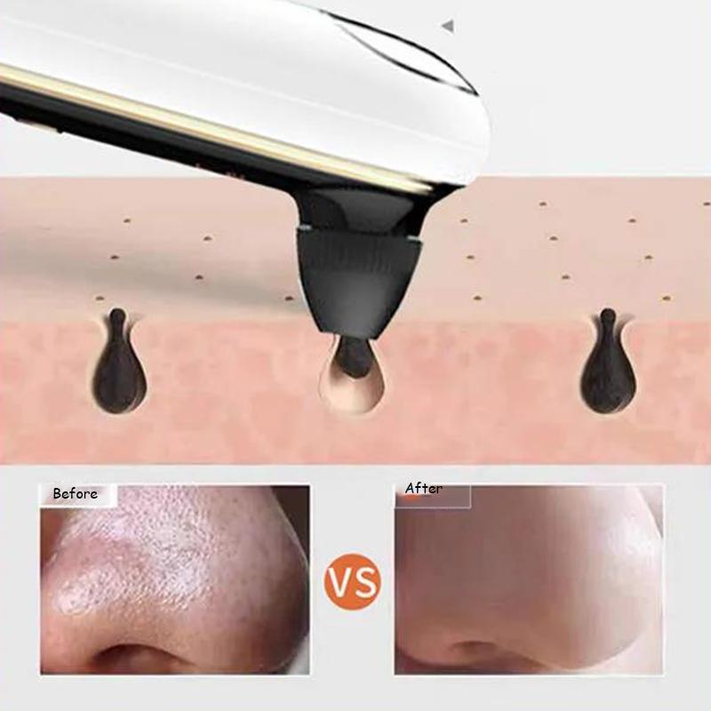 Visual Blackhead Suction Device Beauty Device Facial Multifunctional Blackhead Acne and Mites Cleansing Device To Improve Facial Skin Texture