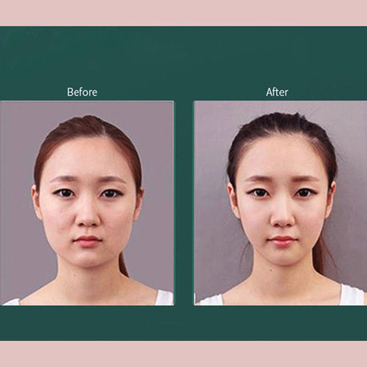 Cold and Hot-dual-purpose Beauty Equipment Facial Multi-function Import Equipment Massage Equipment Lifting and Firming Home Cleansing Equipment