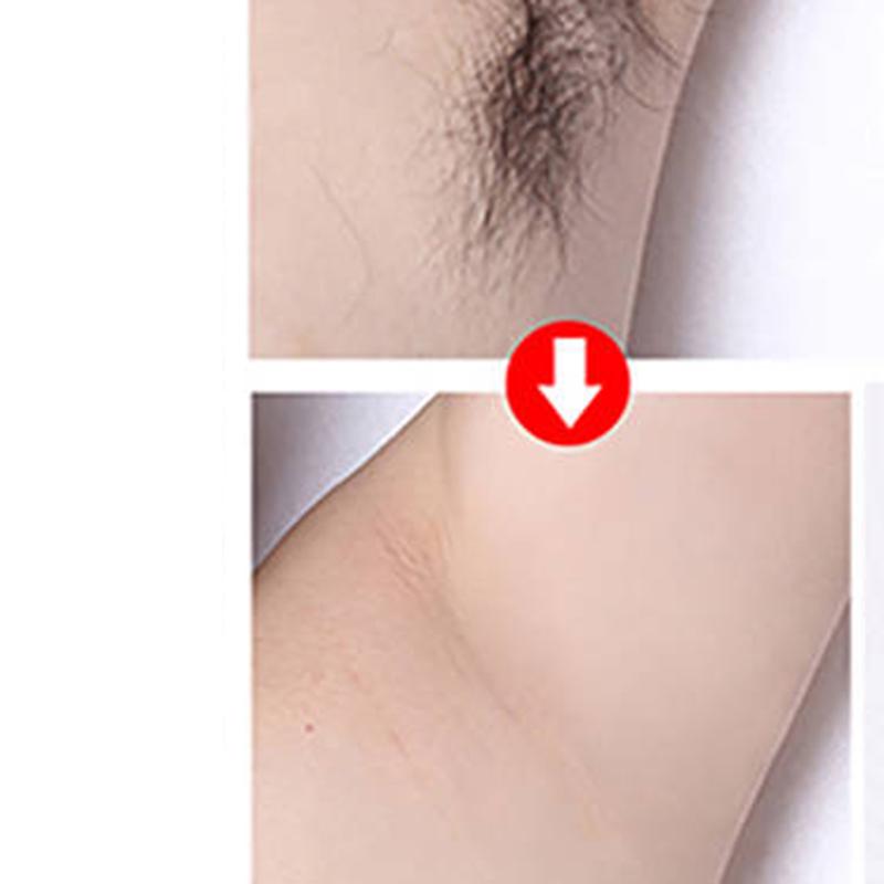 Facial Hair Removal Artifact Velvet Sweat Lip Facial Pluck Face Hair Portable Remover Lady Set