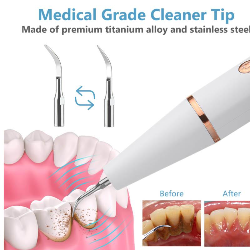 Teeth Whitening and Cleaning Artifact Teeth Cleaning Device Dental Calculus Household Cleaner Tartar Removal Tool Ultrasonic