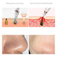 Blackhead Removal Artifact Suction Blackhead Instrument Cleaner Student Wash Face Artifact Blackhead Cleaning Acne Blackhead Suction Device