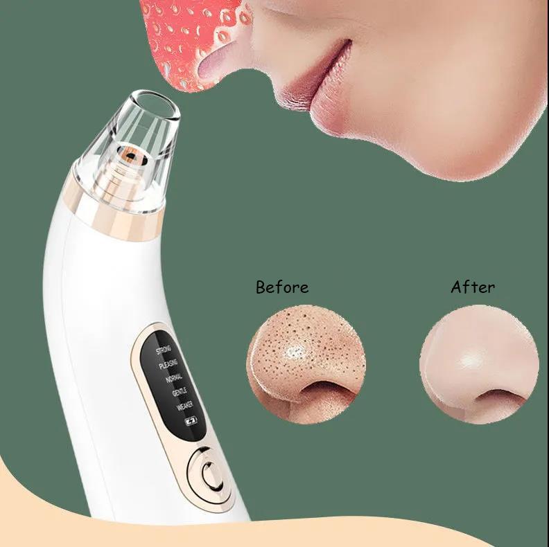 Electric Blackheads Suction Device Pore Cleaner To Remove Blackheads Acne Special Facial Home Beauty Device To Improve Facial Skin