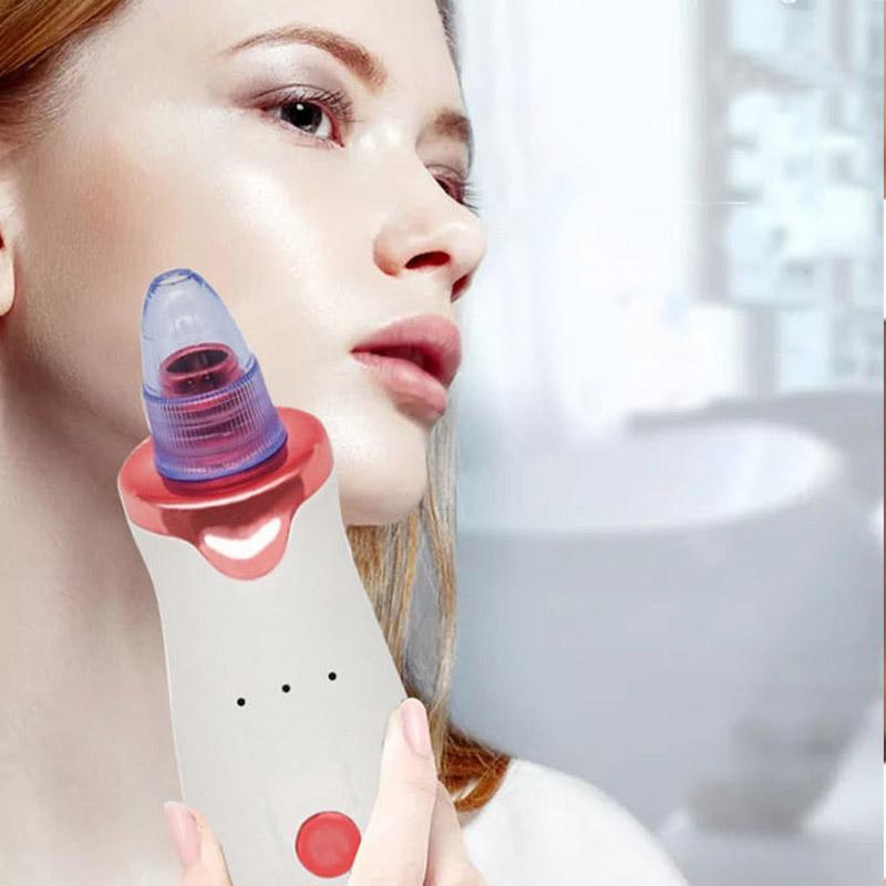 Blackheads Artifact Electric Powerful Suction Blackheads Acne Beauty Equipment To Clean The Student's Face Shrink Pores