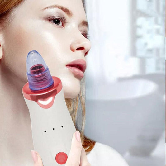 Blackheads Artifact Electric Powerful Suction Blackheads Acne Beauty Equipment To Clean The Student's Face Shrink Pores