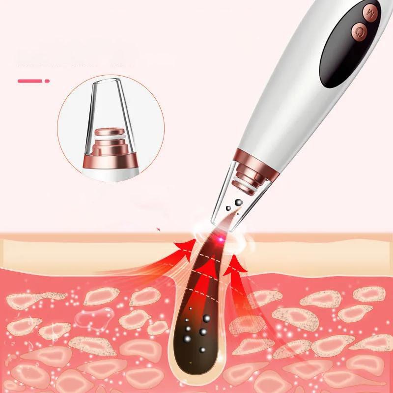 Blackheads Artifact Suction Blackheads Acne Instrument Facial Cleansing Beauty Instrument Small Bubbles Blackheads Shrink Pores Tool