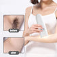 Hair Removal Instrument Permanent Student Laser Lady Long Term Hair Remove Device Electric Shavers