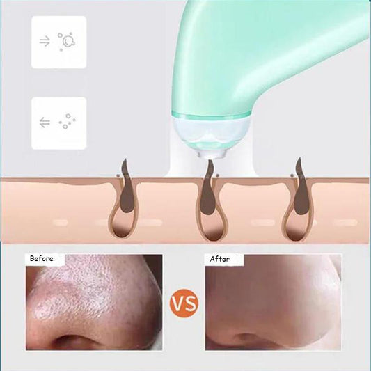 Blackheads Suction Artifact Electric Suction To Remove Pores and Acne Cleansing Small Suction Bubbles Facial Cleansing Beauty Equipment
