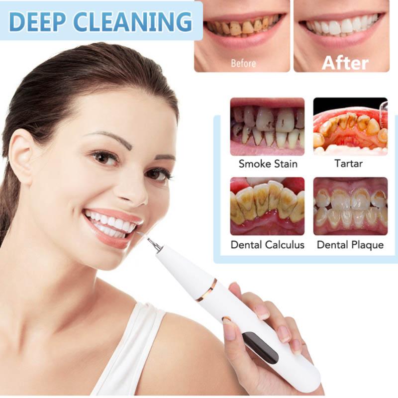 Teeth Whitening and Cleaning Artifact Teeth Cleaning Device Dental Calculus Household Cleaner Tartar Removal Tool Ultrasonic
