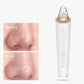 Home Convenient Electric Blackhead Suction Device Pore Cleaning Artifact Cleansing and Brightening Skin Acne Cutin Beauty Equipment