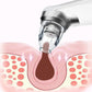 Convenient Household Blackhead Suction Device Electric Pore Cleansing and Beauty Blackhead Exporter To Improve Facial Skin Shine