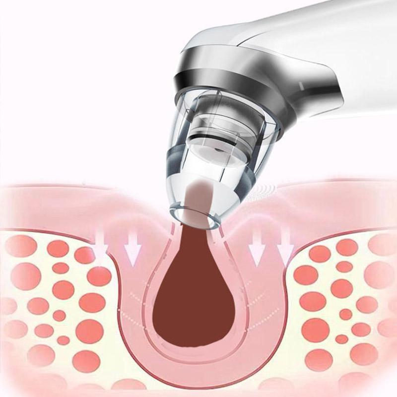 Convenient Household Blackhead Suction Device Electric Pore Cleansing and Beauty Blackhead Exporter To Improve Facial Skin Shine