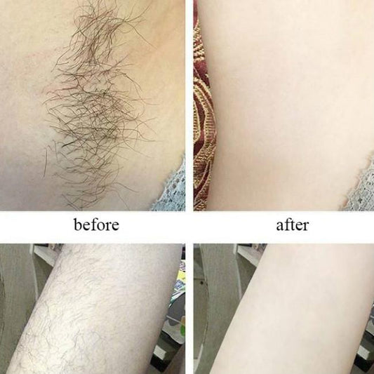 Epilator Permanent Face Lip Underarm Hair Private Parts Laser Freezing Point Hair Removal Instrument