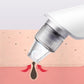 Electric Blackhead Suction Instrument Pore Cleaning Blackhead Artifact Facial Cleansing Instrument To Blackhead Beauty Instruments