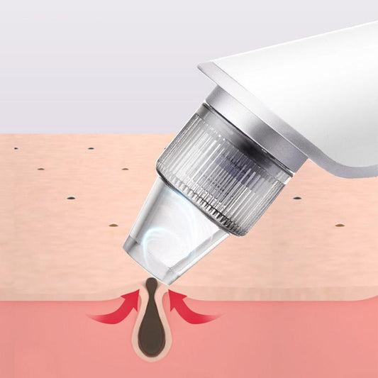 Electric Blackhead Suction Instrument Pore Cleaning Blackhead Artifact Facial Cleansing Instrument To Blackhead Beauty Instruments