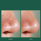 Blackheads Suction Artifact Electric Suction To Remove Pores and Acne Cleansing Small Suction Bubbles Facial Cleansing Beauty Equipment