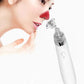 Blackheads Suction Artifact Electric Suction Facial Washing Machine Beauty Pore Removal Machine Acne Facial Cleansing Equipment Facial Ultrasound