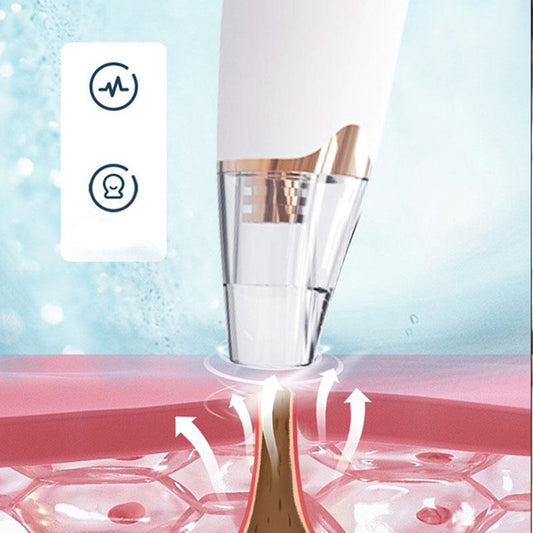 Blackhead Removal Artifact Suction Blackhead Instrument Cleaner Student Wash Face Artifact Blackhead Cleaning Acne Blackhead Suction Device