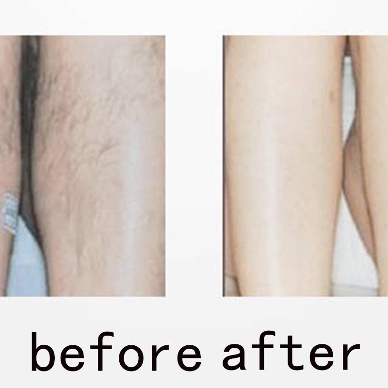 USB Electric Hair Removal Device Waterproof LCD Model Shaver Full Body Private Hair Shaving